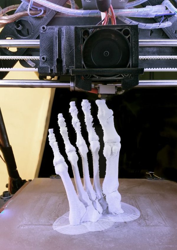 p14 and 16 bones 3D Printing Medical_2.jpg