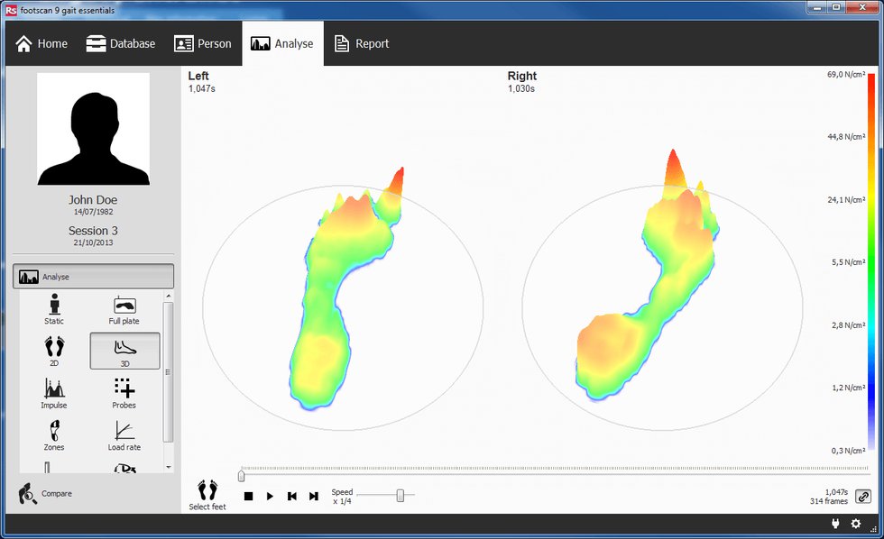 RS Footscan 3D Analysis
